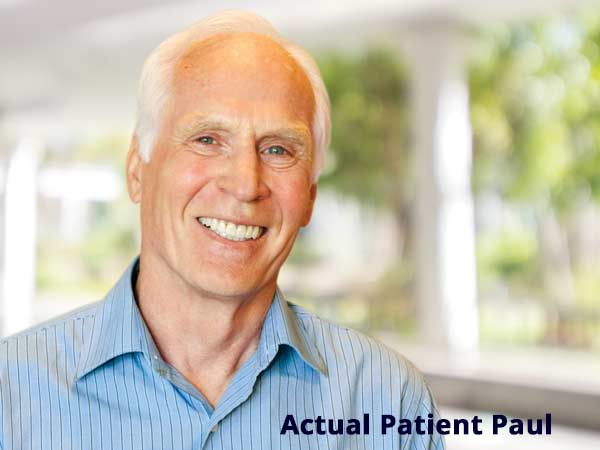 Actual Patient Paul